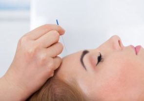 Akupunktura estetyczna i moksoterapia